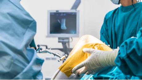 Joint Replacement Procedure