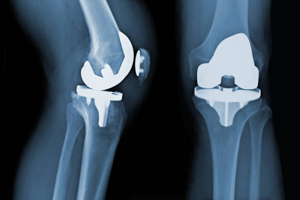 Orthopedic Consultation