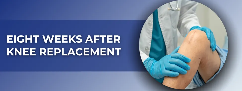 What to Expect Eight Weeks After Knee Replacement