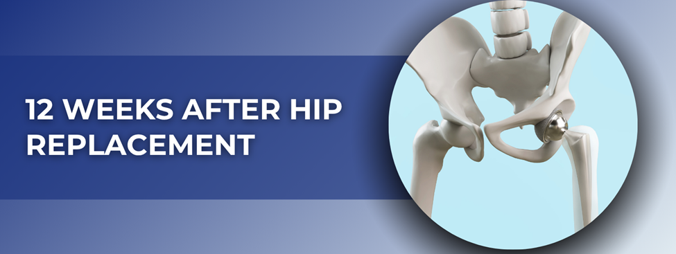 12 Weeks After Hip Replacement